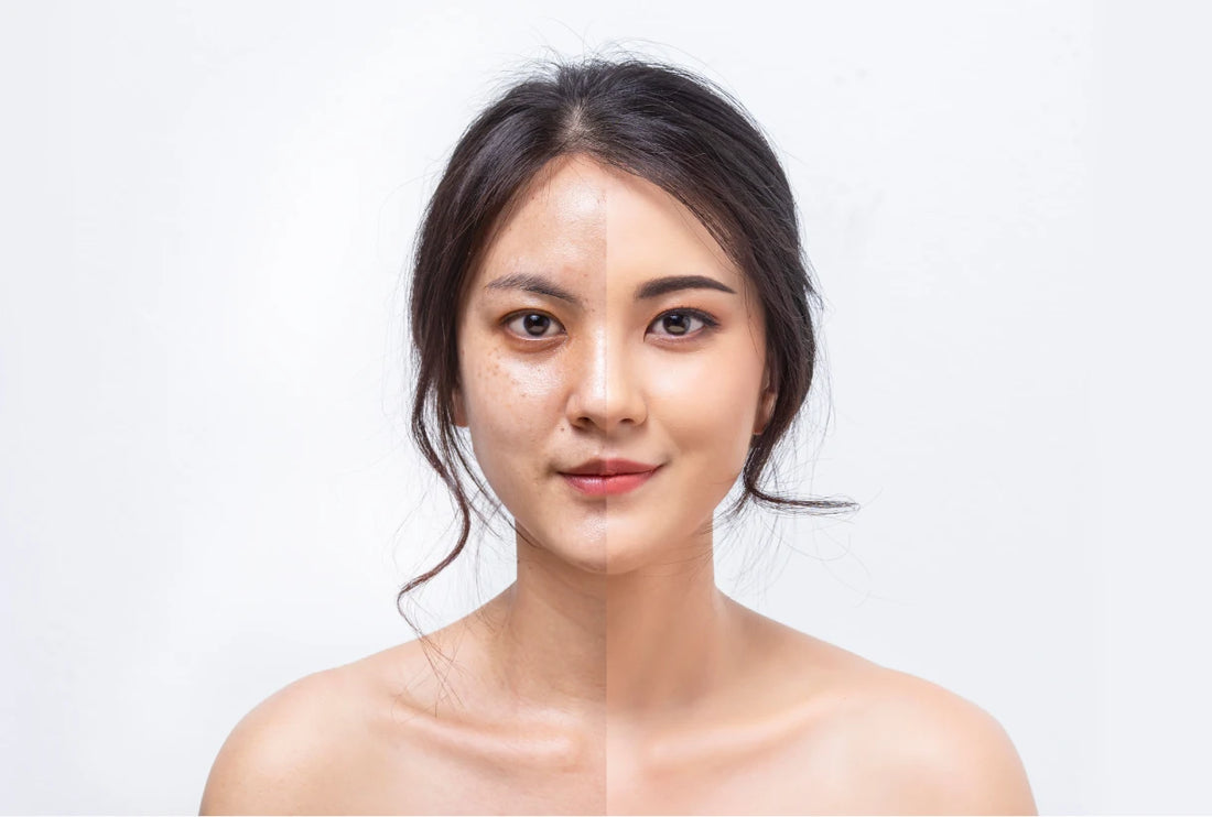 How skin care vitamins make your skin healthier and younger than before?